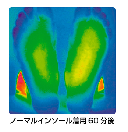 ノーマルインソール着用60分後のサーモグラフィ